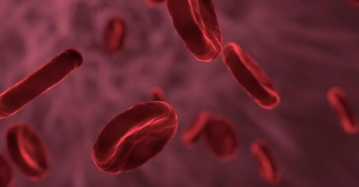 Pernicious anemia and vitamin B12 deficiency